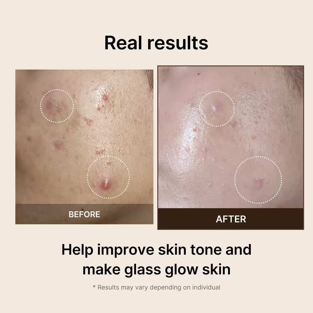 Medicube Deep Vita C Pads Brightening