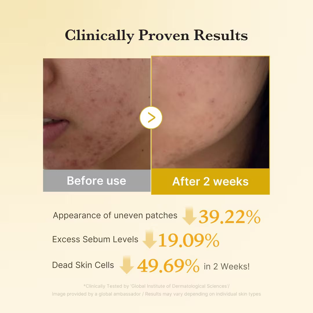 Medicube Kojic Acid Turmeric Brightening Pad 70 Pads