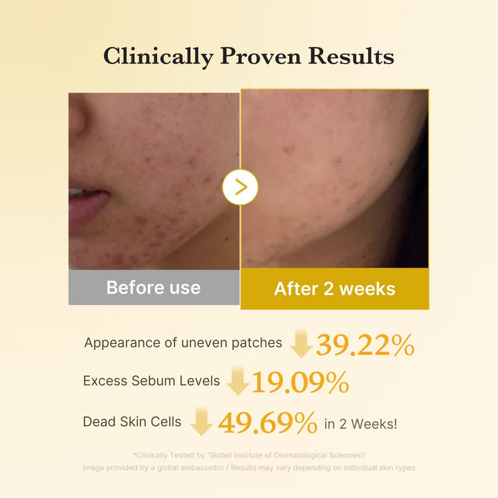 Medicube Kojic Acid Turmeric Brightening Pad 70 Pads